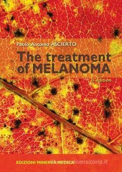 The treatment of melanoma