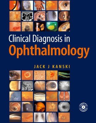 Clinical Diagnosis in Ophthalmology