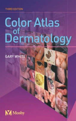Color Atlas of Dermatology