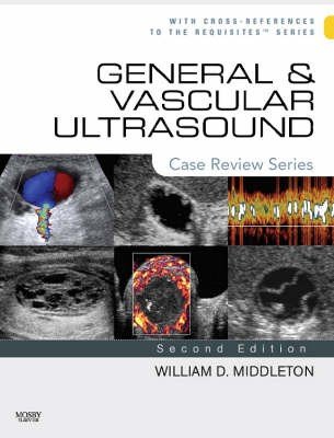 General and Vascular Ultrasound