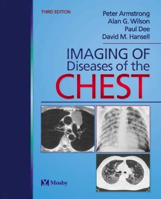 Imaging of Diseases of the Chest