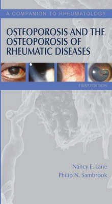 Osteoporosis and the Osteoporosis of Rheumatic Diseases
