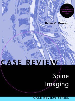 Spine Imaging
