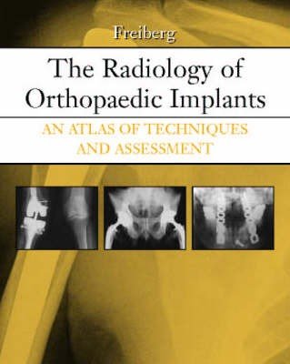 The Radiology of Orthopaedic Implants