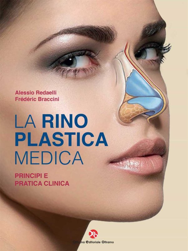 La rinoplastica medica. Principi e pratica clinica