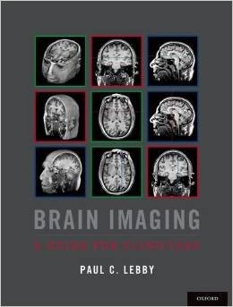 Brain Imaging