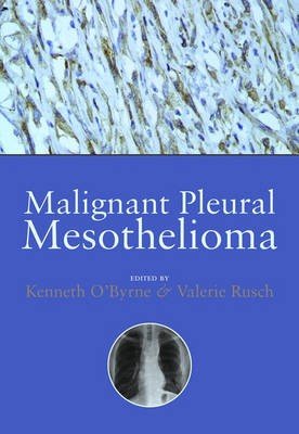 Malignant Pleural Mesothelioma
