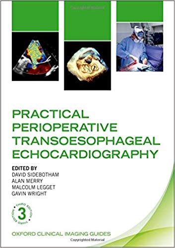 Practical Perioperative Transoesophageal Echocardiography