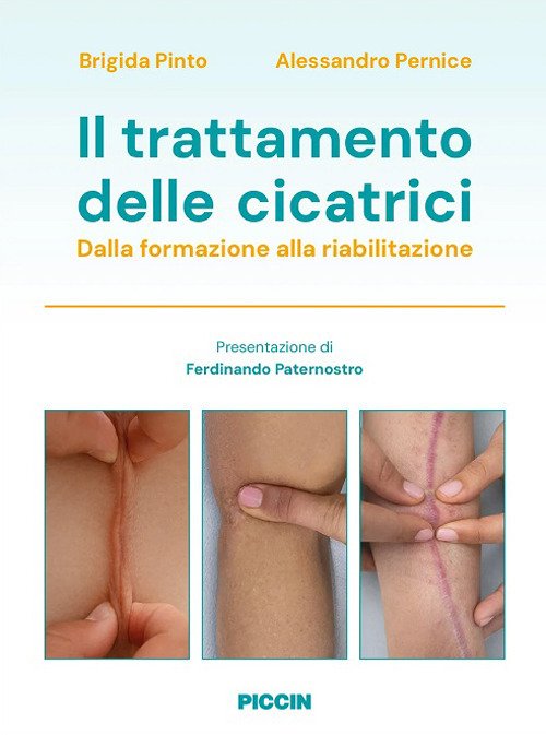 Il trattamento delle cicatrici. Dalla formazione alla riabilitazione