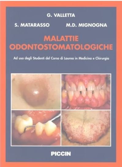 Malattie odontostomatologiche