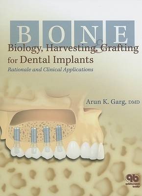 Bone Biology, Harvesting and Grafting for Dental Implants