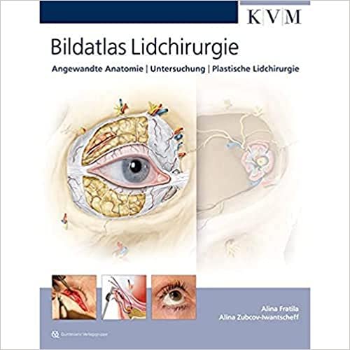 Bildtatlas  Lidchirurgie Angewandte Anatomie Untersuchung Plastische Lidchirurgie