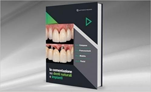 La cementazione su denti naturali e impianti