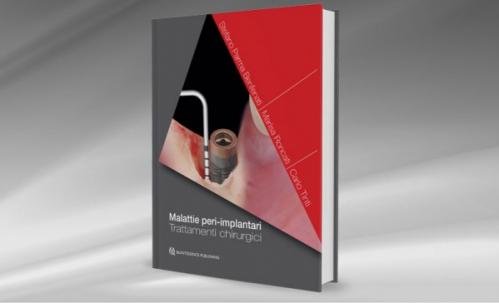 Malattie peri-implantari. Trattamenti chirurgici
