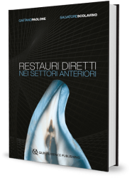 Restauri diretti nei settori anteriori