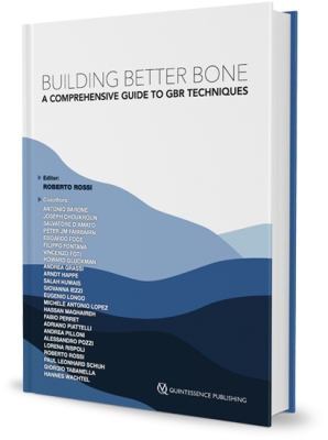 Building Better Bone. A Comprehensive Guide to GBR techniques