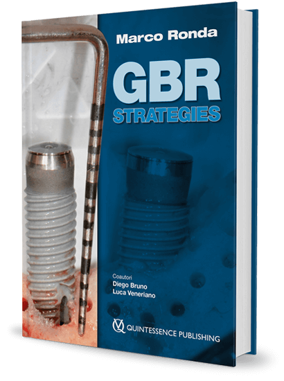 GBR Strategies