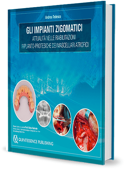 Gli impianti zigomatici. Attualità nelle riabilitazioni implanto-protesiche dei mascellari atrofici