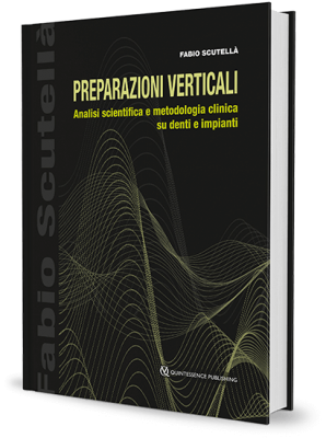 Preparazioni verticali. Analisi scientifica e metodologia clinica su denti e impianti