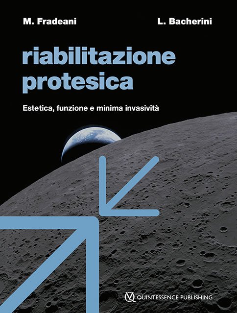 Riabilitazione protesica