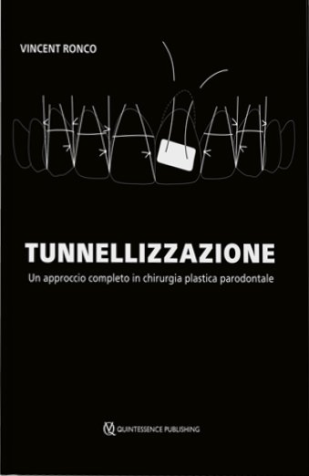 Tunnellizzazione