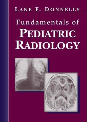 Fundamentals of Pediatric Radiology