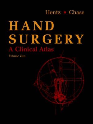 Hand Surgery