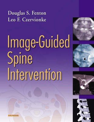 Image Guided Spine Intervention