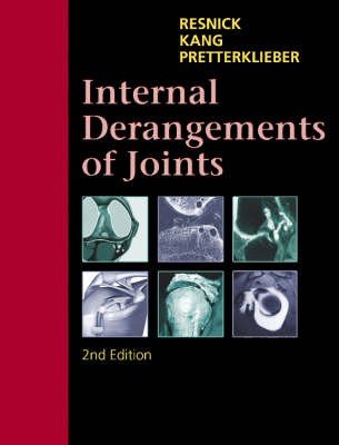 Internal Derangements of Joints