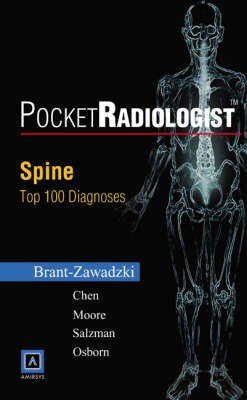 Spine