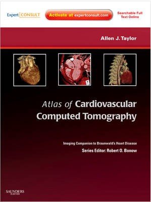Atlas of Cardiovascular Computed Tomography