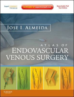 Atlas of Endovascular Venous Surgery