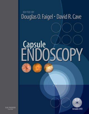 Capsule Endoscopy