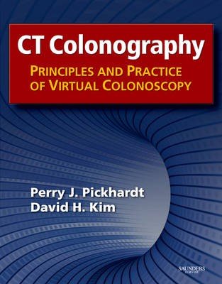 CT Colonography