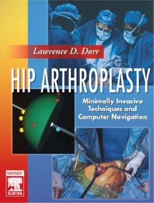 Hip Arthroplasty