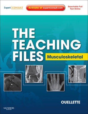 Musculoskeletal