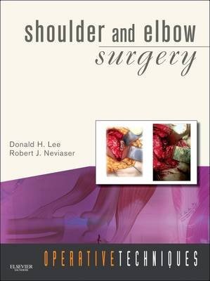 Operative Techniques: Shoulder and Elbow Surgery