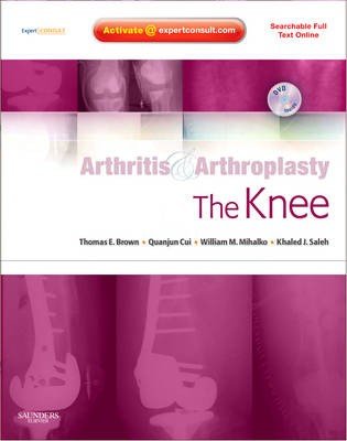 The Knee