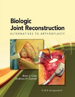 Biologic Joint Reconstruction