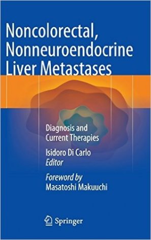 Noncolorectal, Nonneuroendocrine Liver Metastases