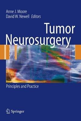 Tumor Neurosurgery
