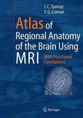 Atlas of Regional Anatomy of the Brain Using MRI