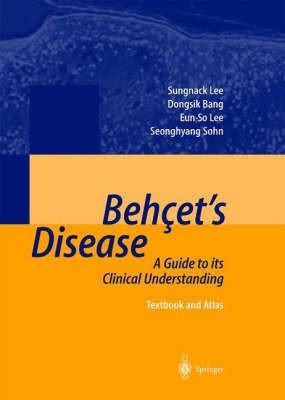 Behcet's Disease