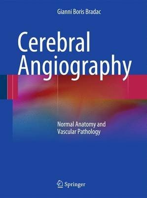 Cerebral Angiography