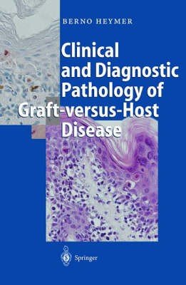 Clinical and Diagnostic Pathology of Graft-versus-Host Disease