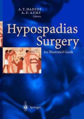 Hypospadias Surgery