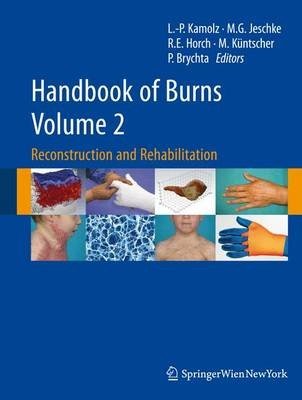 Handbook of Burns