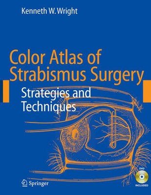 Color Atlas of Strabismus Surgery