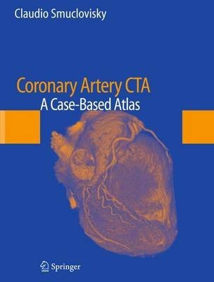 Coronary Artery CTA