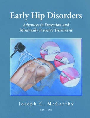 Early Hip Disorders